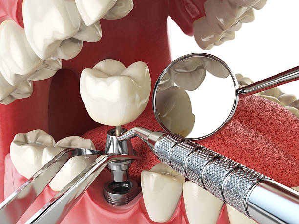Best After-Hours Dental Trauma Care in Ogden, KS